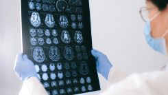 Gut Virus May Play a Role in Alzheimer’s Onset, New