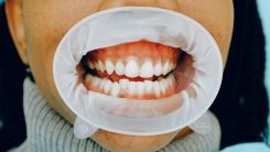 Neanderthal-Inherited Gene Shapes Our Teeth, Research Finds