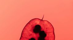 High-Throughput Sequencing as Key to Advancing Thalassemia Prevention