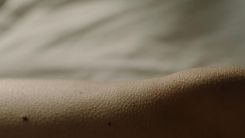 Can AI Predict Which Moles Need Removal?