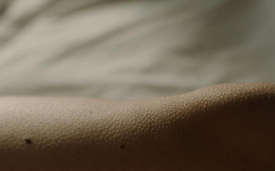 Can AI Predict Which Moles Need Removal?