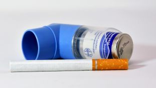 Asthma