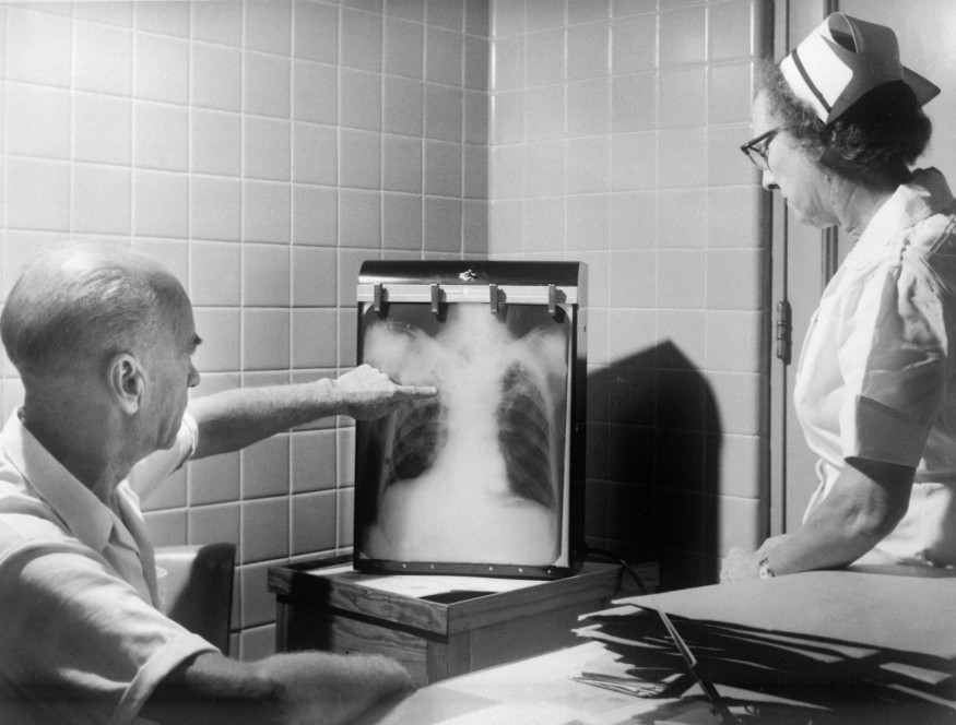 New York City's Tuberculosis Crisis Is Not Over