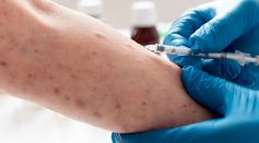 Measles Transmission Persists Across Texas Into Summer 2026 Amid Ongoing