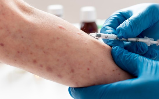 Measles Transmission Persists Across Texas Into Summer 2026 Amid Ongoing