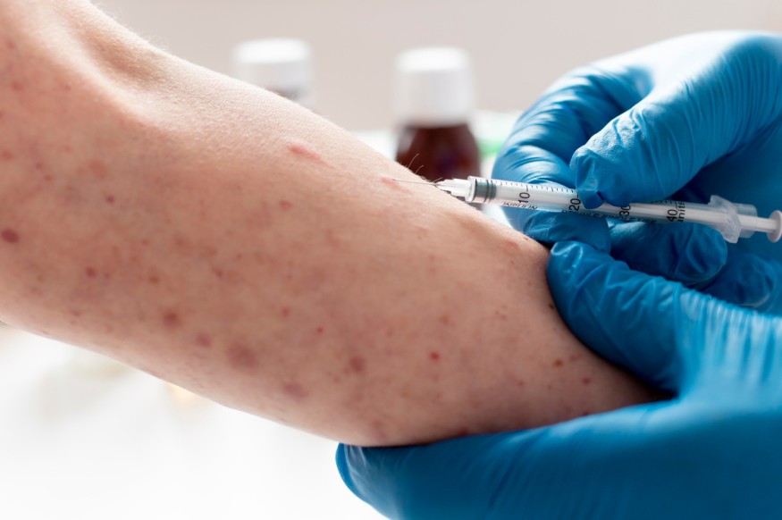 Measles Transmission Persists Across Texas Into Summer 2026 Amid Ongoing