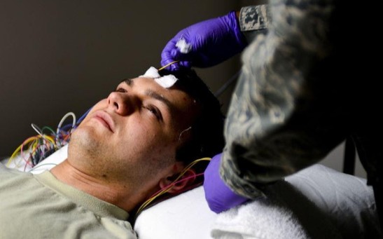 What are the Most Common Neurological Disorders?