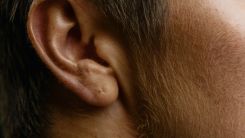 The Wax Whisperer Extracts Nearly 16 Years' Worth of Earwax