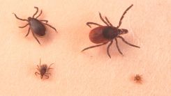 VLA15 May be the First Vaccine Against Lyme Disease