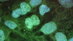French Scientists Develop Mini-Intestine Organoid To Mimic Multiple Intestinal Functions