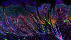 Genetic Switch in Baby Mice Can Activate Adult Skin Repair Without Scarring
