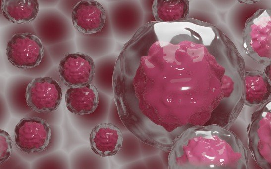 Women at Higher Risk of Ovarian Cancer Have This Genetic Mutation, Scientists Reveal