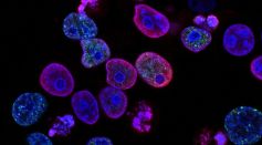 Cancer Treatment: Novel Computational Approach Can Identify Genomic Safe Harbors for Therapeutic Genes