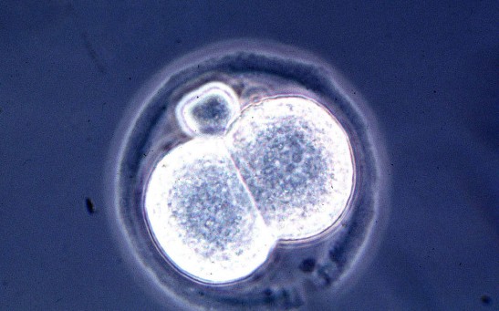 Diagnostic, Treatment Strategy for Cancers Study How Stabilizing Chromosomes Help in Dealing with Tumors