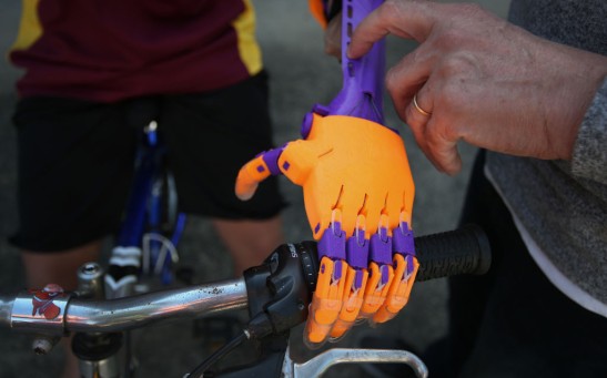 Hair Salon Waste Used To Create Prosthetics