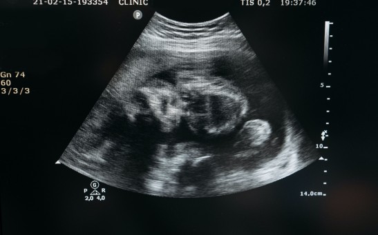 Unborn Babies Respond to Flavors From Foods Their Mothers Eat, Study Reveals