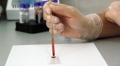 How Can Blood Test Predict Alzheimer's Disease Risk? Scientists Looked at Changes in Neurogenesis Prior to Clinical Diagnosis