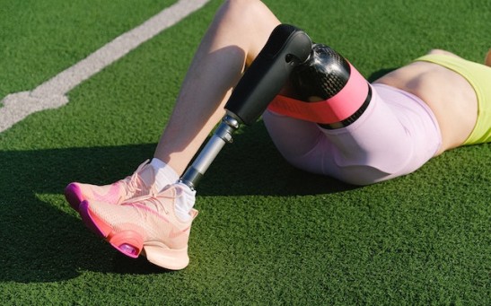 Bone Cancer Survivor Had His Foot Sewn Backward After Amputation But Got His Independence Back