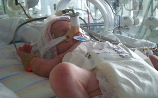 Artificial Womb Recreates Environment for Fetal Development, Provides Protective Chamber for Extremely Premature Babies