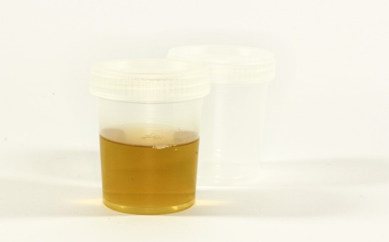urine